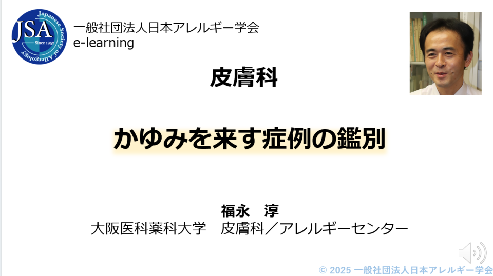 [SHOULD]かゆみを来す症例の鑑別 | 日本アレルギー学会 E-learning for Allergy Trainees(EAT)
